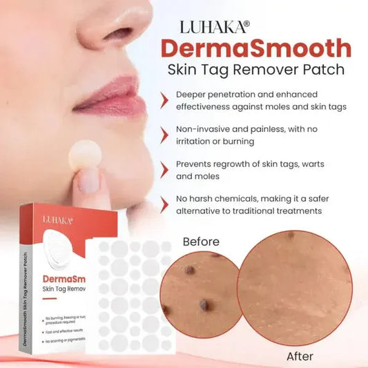 DermaSmooth Skin Tag Remover Patch-Solution With No Scarring Or Pigmentation